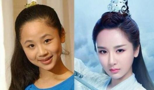 明星怎么整容的,他们是如何变美的？